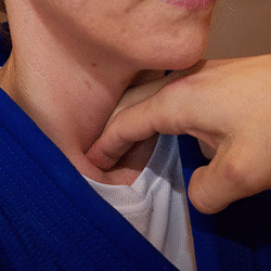 Kehlkopfgrubendruck01.gif