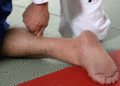 Archillessehnendruck01.gif
